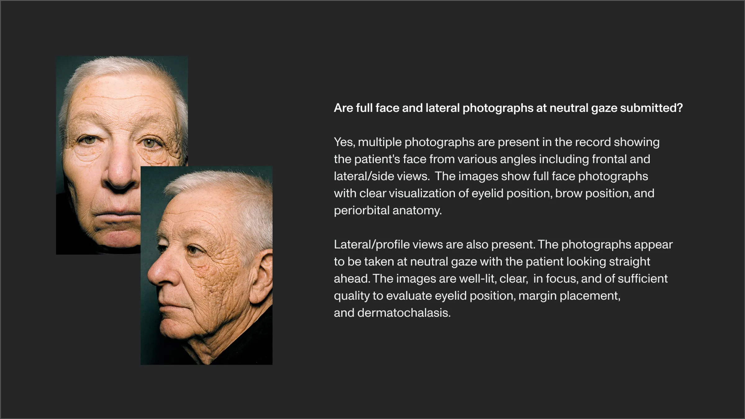 Exhibit answering 'Are full face and lateral photographs at neutral gaze submitted?' with 'Yes' and supporting explanation text on the right. On the left are two patient photos: a full-face frontal portrait of an older man and a lateral (side profile) portrait of an older woman, both showing periorbital and facial anatomy for eyelid position assessment.